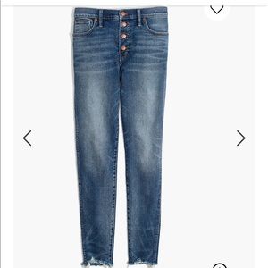Madewell 10” High Rise Skinny
